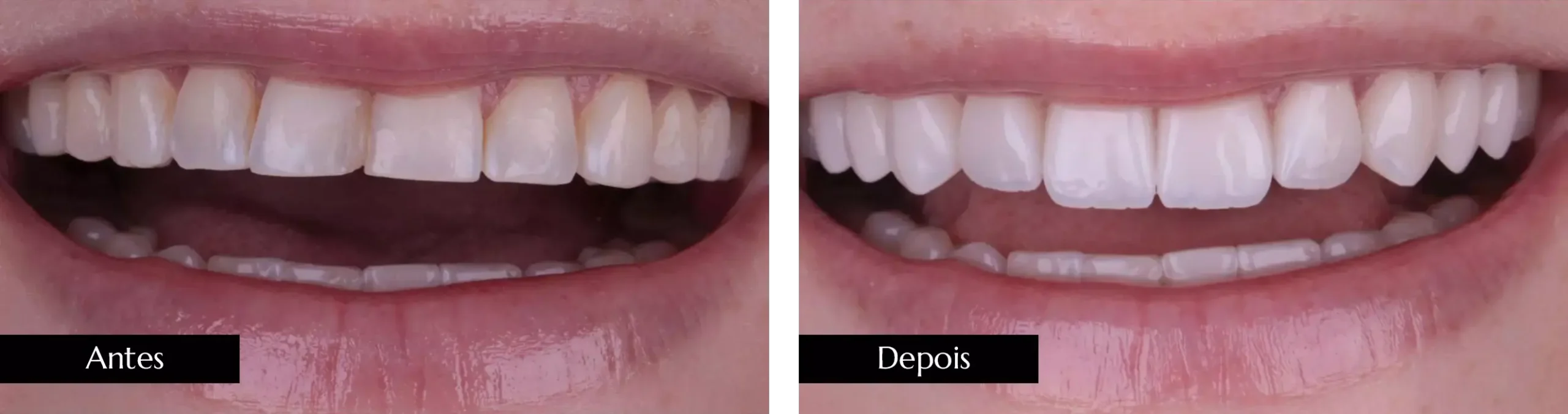 AnyConv.com__ant dps 01