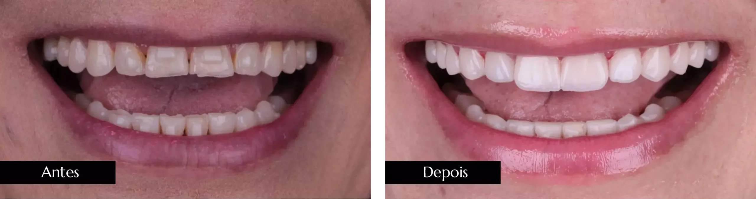 AnyConv.com__ant dps 02