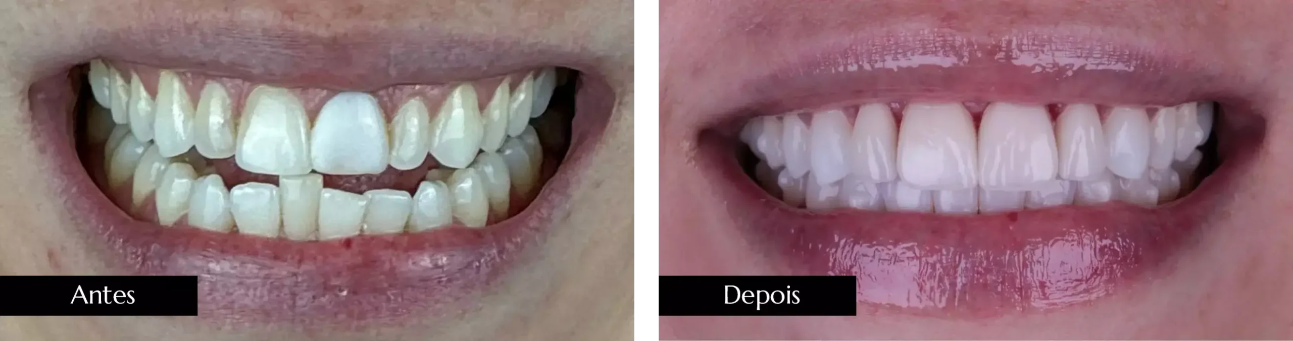 AnyConv.com__ant dps 03