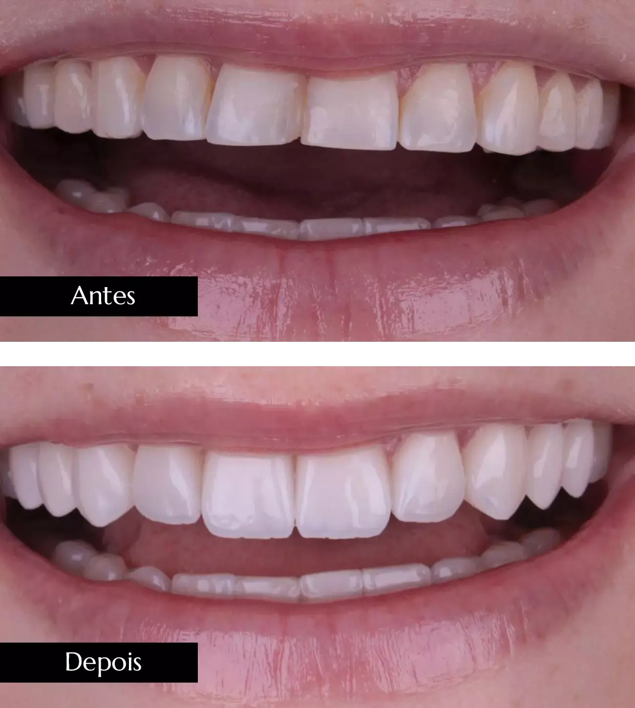 AnyConv.com__ant dps mob 01