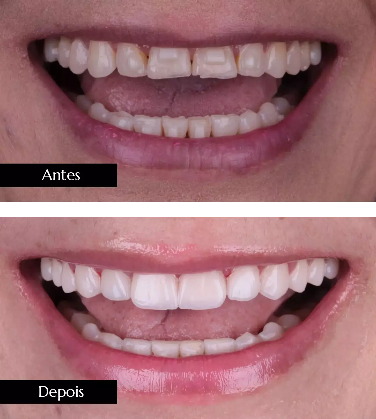 AnyConv.com__ant dps mob 02