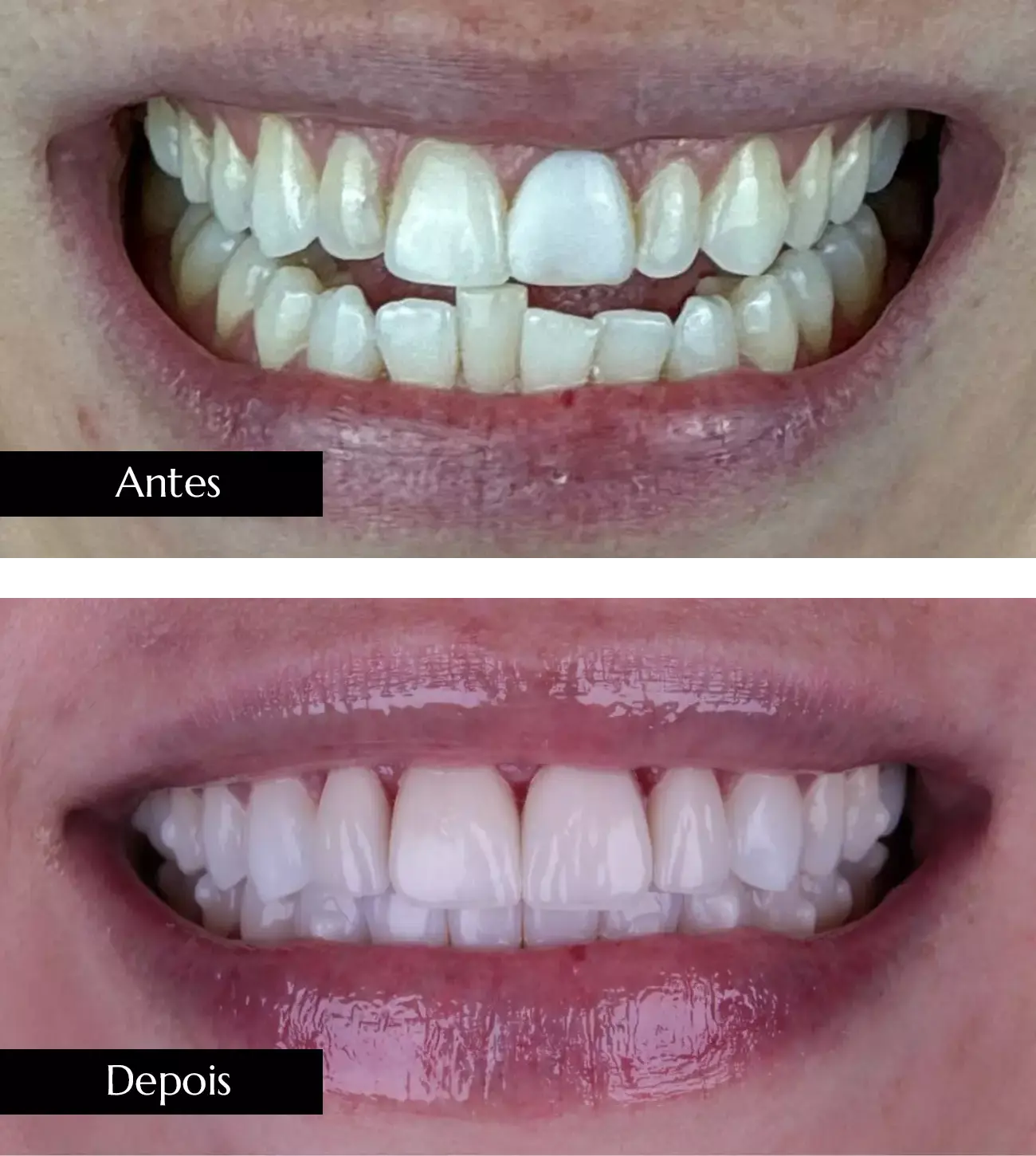 AnyConv.com__ant dps mob 03